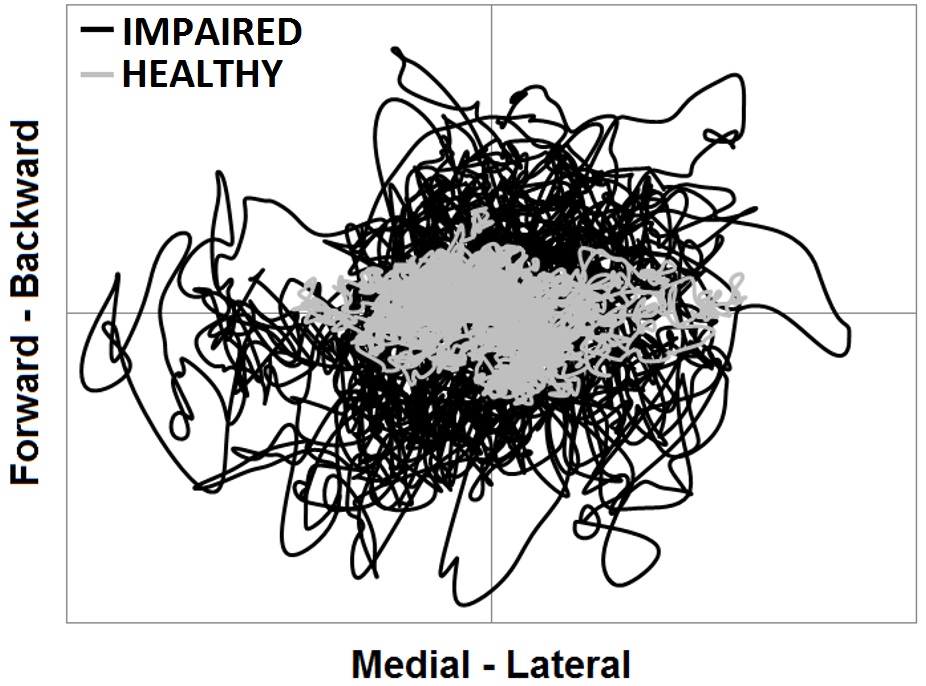 Wii Balance Board tools — original illustration